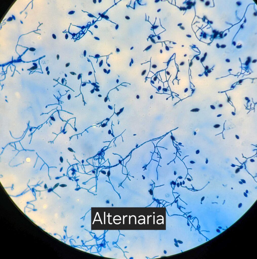 Schimmelpilz Mikroskop