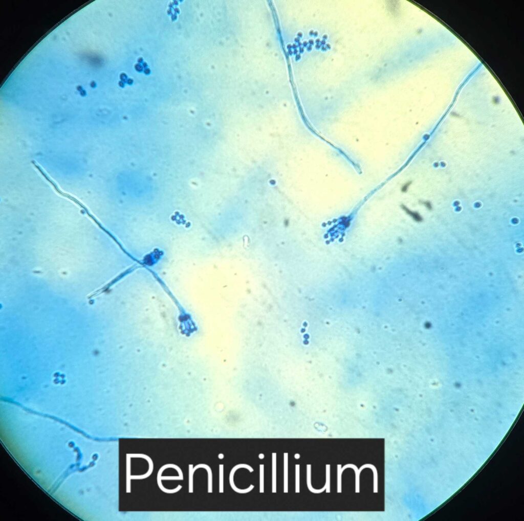 Schimmelpilz Mikroskop