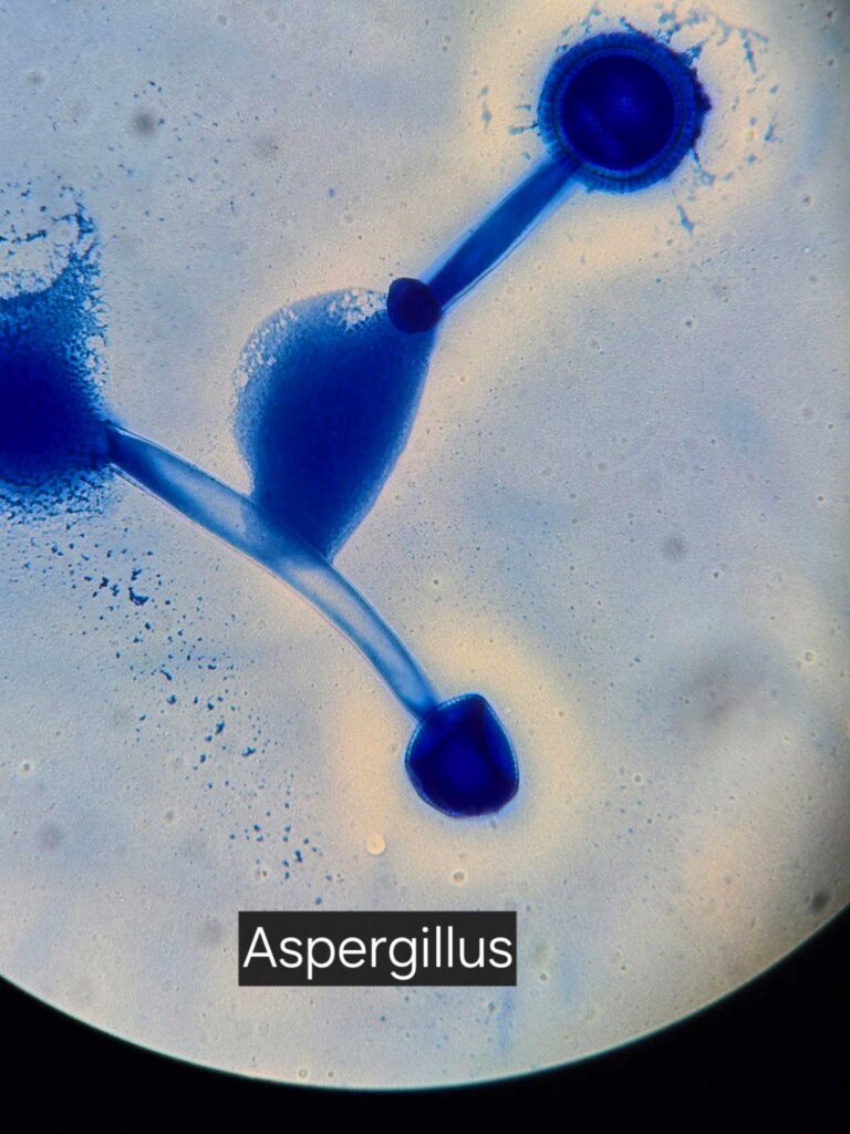 Schimmelpilz Mikroskop